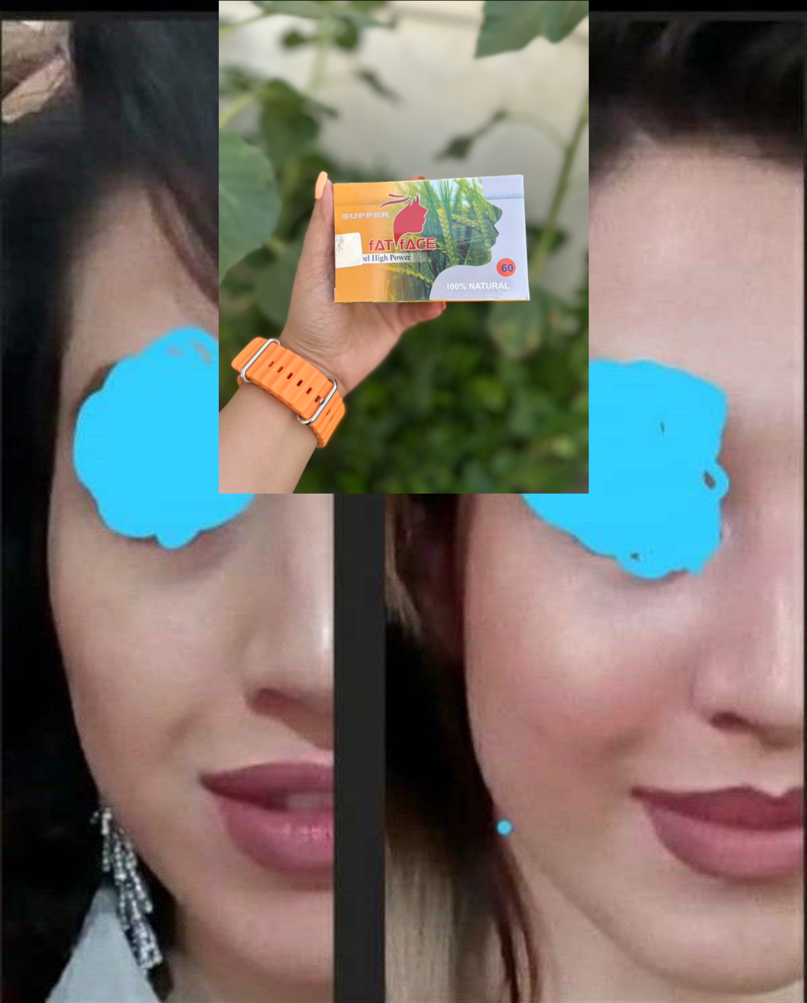 قرص فت فیس | مکمل زیبایی صورت برای کمک به ظاهر پرتر و شاداب‌تر چهره
