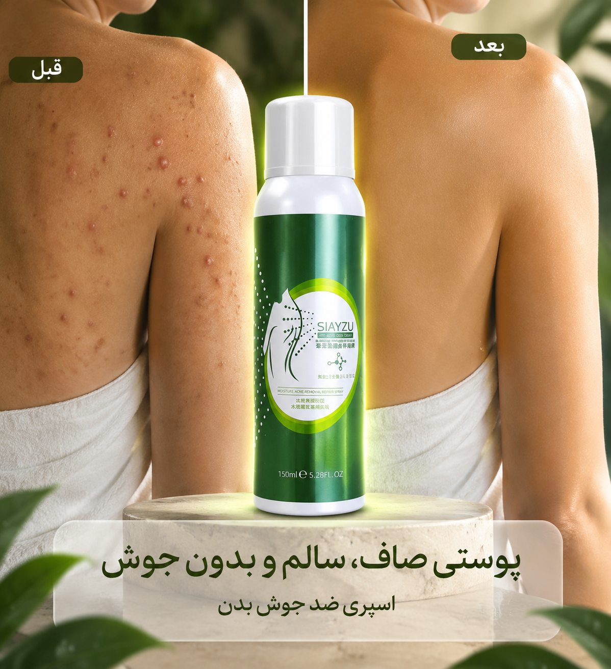 اسپری ضدجوش فوری