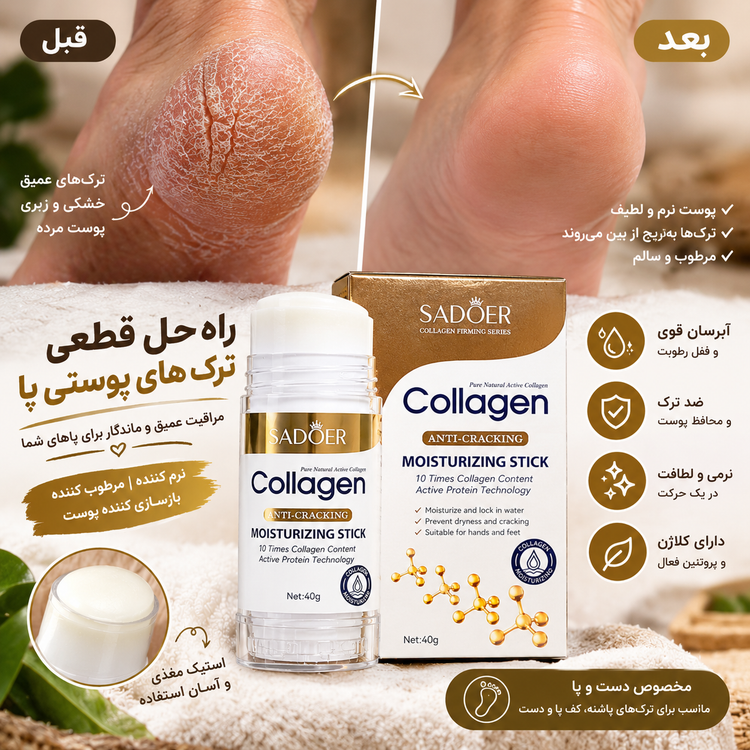 استیک مرطوب کننده دست و پای سادور| رفع خشکی و ترکهای پوستی|حاویه کلاژن